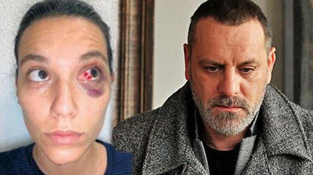 2. Sevgilisi Deniz Bulutsuz'u darp ettiği iddiasıyla hakkında dava açılan Ozan Güven'in 'basit yaralama' gerekçesiyle şikayetçi olduğu davada yeni bir gelişme yaşandı!