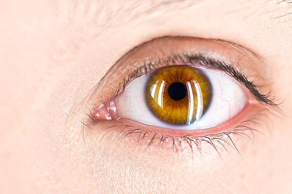 9. Lazerle göz ameliyatı geçirirken gözünüzün yanan kısımlarının kokusunu alabilirsiniz.