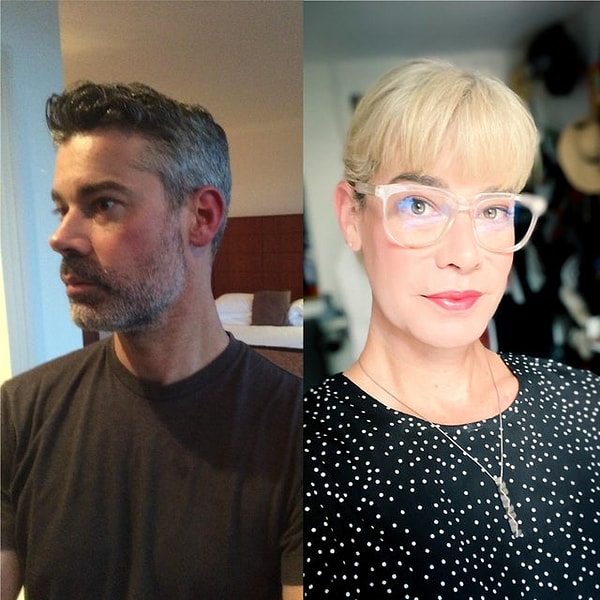 16. «2013 vs 2020. 18-й месяц гормональной терапии».