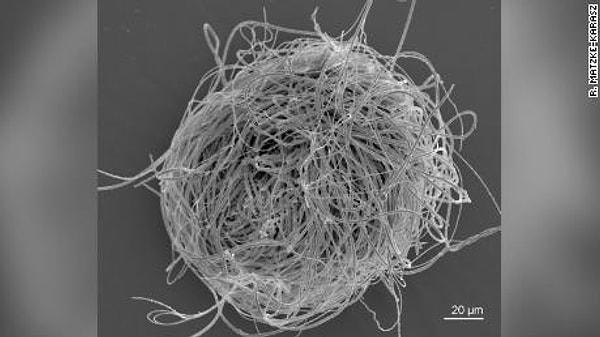 0,59 mm büyüklüğündeki dişi myanmarcypris huinin içinde dört yumurta ve seminal yuvalarında bir sperm tespit edildi.