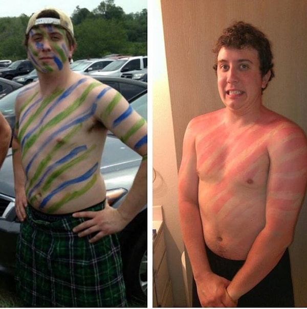 1. Эти полоски уж точно пробудут с ним долго