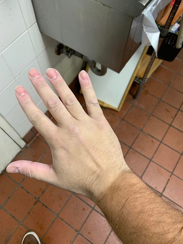 4. Когда все лето носил перчатки