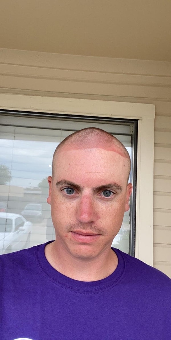 6. «Побрил голову и целый день ходил с банданой на лбу. Результат — шикарная линия загара»