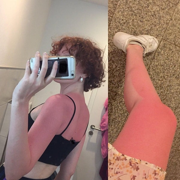 14. «Выгляжу как варёная креветка, после того как час сидела, закинув ногу на ногу»