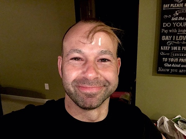 11. Инновационное средство для борьбы с облысением