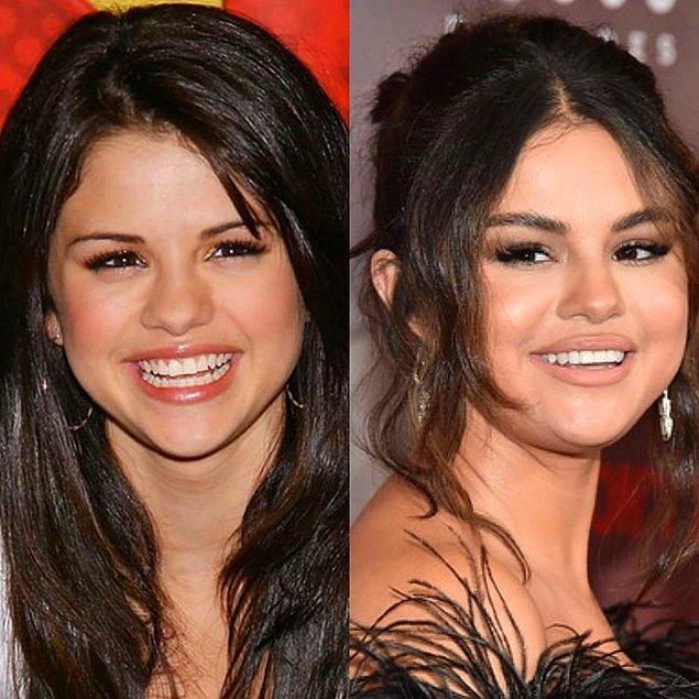 5. Selena Gomez de doğal dişlerini korumak yerine daha yapay bir görüntü tercih etmiş.