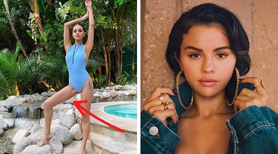 Селена Гомес, которой в 2017 году сделали пересадку почки, впервые за эти годы показала шрам!