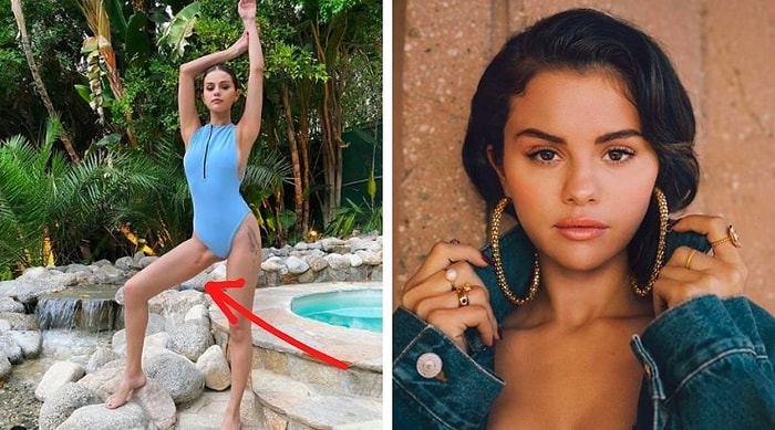 Селена Гомес, которой в 2017 году сделали пересадку почки, впервые за эти годы показала шрам!