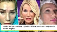 Estetiğin de Bu Kadarı... Yüzünü Fransız Askı Yöntemiyle İple Gerdiren Seda Sayan'ın Görüntüleri Herkesi Gerdi!