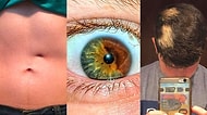 İnsanların Kendilerinde Keşfettiği ve Vücutlarımızın Ne Kadar Eşsiz Olabileceğini Kanıtlayan 20 Şaşırtıcı Fotoğraf