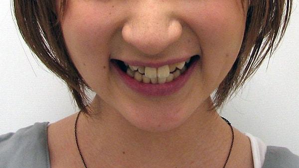 8. Mükemmel olmayan dişler Japonya'da tatlı bulunur.