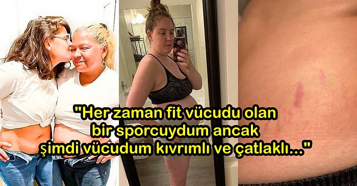 Tüm Gerçekliği ile Doğum Sonrası Vücutlarını Paylaşan 14 Annenin Güç ve Güzellikle Dolu Fotoğrafları