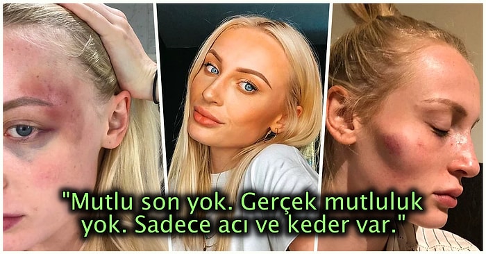 Peri Masalı Gibi Başlayan İlişkisinin Nasıl Duygusal ve Fiziksel Şiddete Evrildiğini Anlatan Model