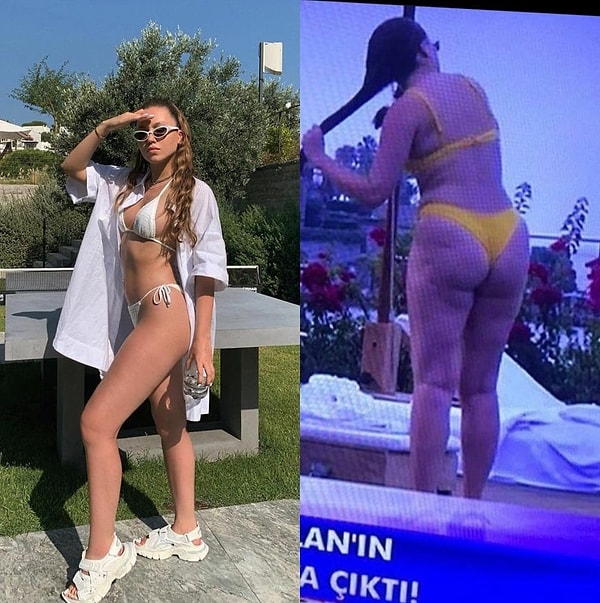 5. «Одна из самых популярных блогеров у меня в стране. Сотни тысяч маленьких девочек идеализируют её неестественное тело»