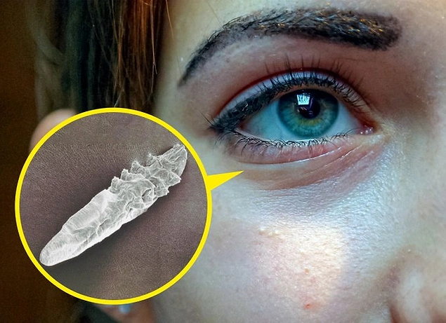 Bunca zamandır, cildimizi yüzyıllardır evi bellemiş mikroskobik akarlarla paylaşıyoruz desek sizleri bir miktar korkutabiliriz.