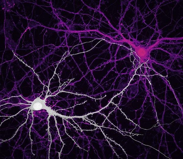 9. Beyin hücrelerindeki elektrik bağlantıları / Yarışma 9.su - Jason Kirk, Quynh Nguyen
