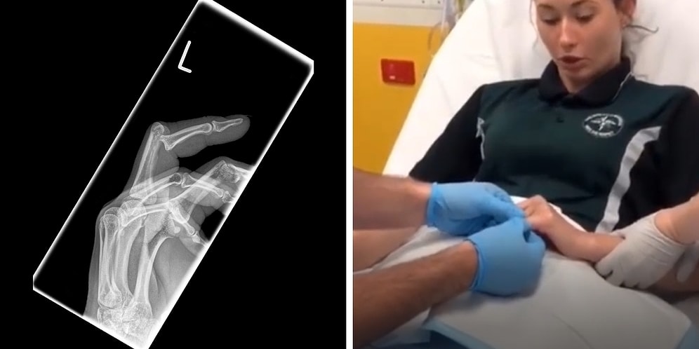 Serçe Parmağı Çıkan Kadının Doktordayken Ölüp Ölüp Dirildiği Anlar