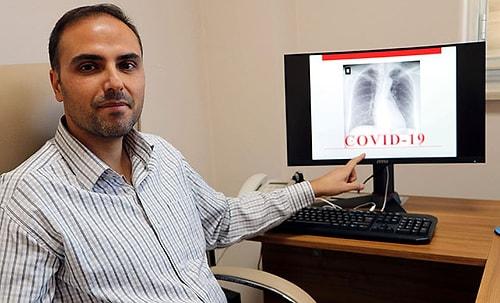Geliştirdiği Yapay Zekayla Röntgen Filmlerinden Saniyeler İçinde Koronavirüs Teşhisi Yapıyor