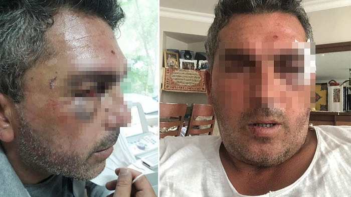 İstanbul'da Kurye Dehşeti! Tartıştıkları Adamın Motosikletle Başını Ezmeye Çalıştılar