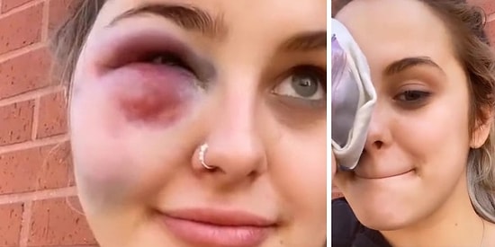 Alkolü Fazla Kaçırdıktan Sonra Direğe Çarpan Kadın Hayatının Şokunu Yaşadı