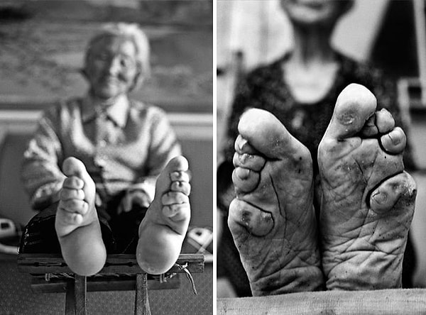 4. Китайская традиция 10 века - перевязка ног