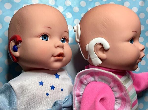Bright Ears UK'yi kuran Clare Tawell ürettiği bebekleri çeşitli tıbbi rahatsızlıkları olan çocuklara benzeyecek şekilde tasarlıyor.