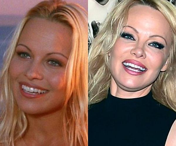 17. Pamela Anderson