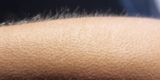 Tüylerini Diken Diken Eden, Dişlerini Kamaştıran Yiyeceği Söylüyoruz!