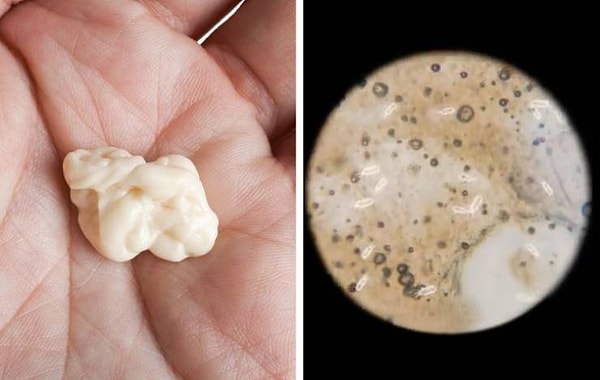 6. Жевательная резинка