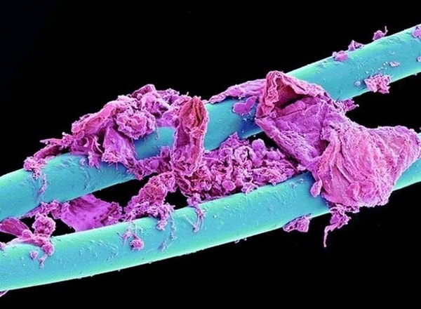 20. Использованная зубная нить