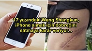 17 Yaşında iPhone Alabilmek İçin Böbreğini Sattıktan Sonra Yatağa Bağlı Yaşamak Zorunda Kalan Genç Çocuk