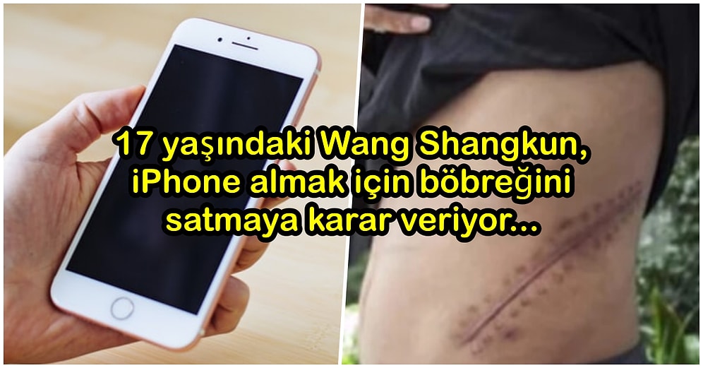 17 Yaşında iPhone Alabilmek İçin Böbreğini Sattıktan Sonra Yatağa Bağlı Yaşamak Zorunda Kalan Genç Çocuk