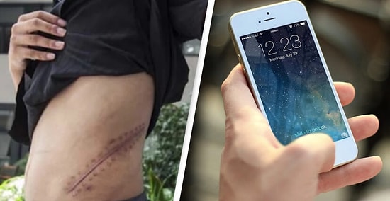 17-летний подросток, который продал свою почку ради iPhone, теперь прикован к постели на всю жизнь