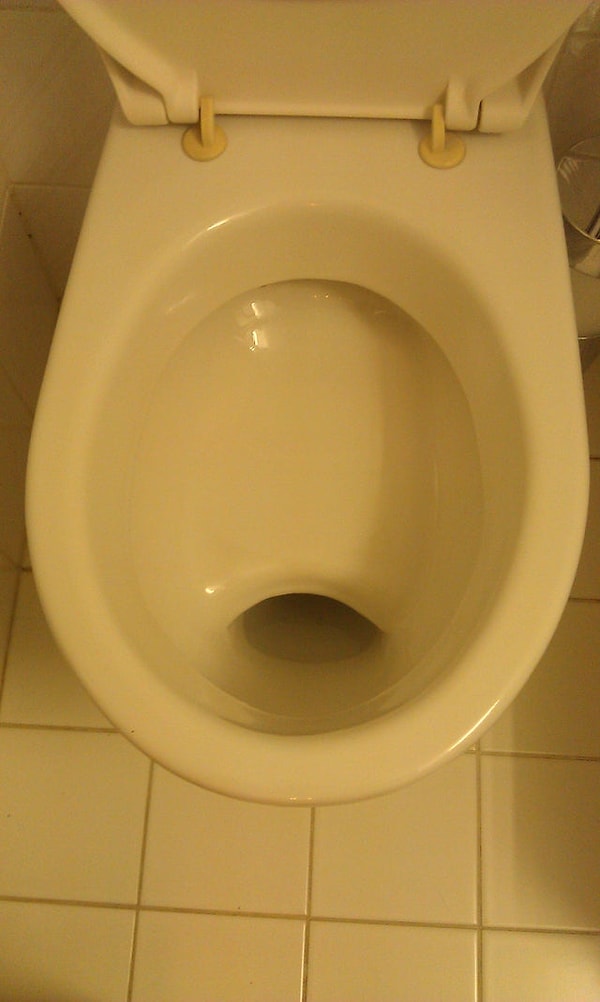 В австрийских унитазах есть специальная полочка, этакая поверхность, где содержимое кишечника задерживается перед отправлением в канализацию.