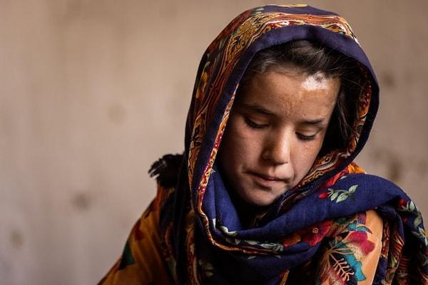 Afganistan'ın Faryab ilinde yaşayan Shogofa: