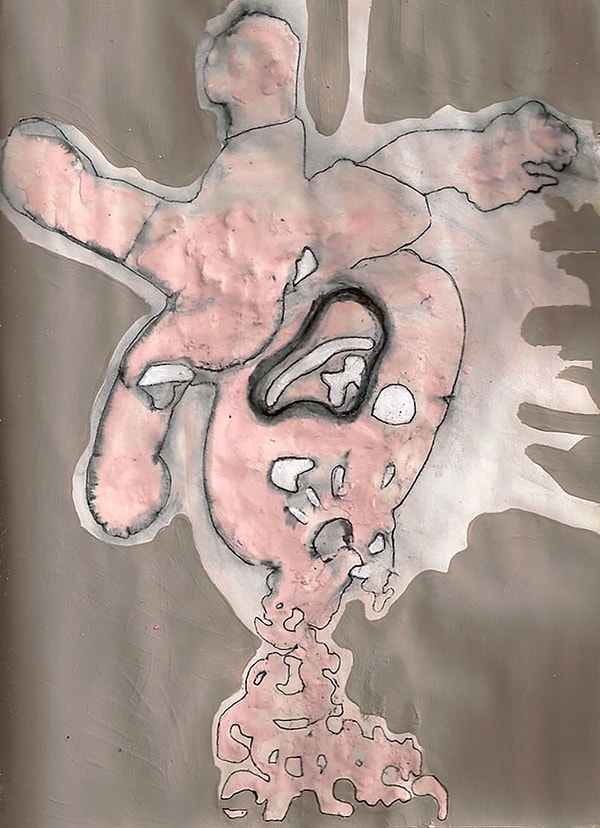 17. 90 мг Арипипразол (после 3 месяцев использования максимальной дозы)