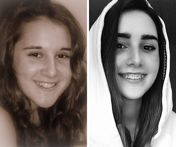 20. "Брекеты стали моим спасением"