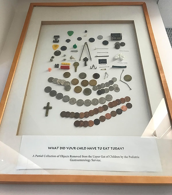 1. Коллекция предметов, проглоченных детьми.