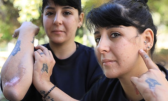 Döner Bıçağıyla Yaralayan Eşi Tahliye Olan Gizem: İşini Tamamlamak İçin Gelecek