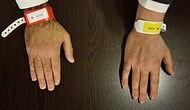 Kovid-19 Test Sonucu Pozitif Çıkanlara Kırmızı, Pozitif Kişilerle Temaslı Olanlara Beyaz Bileklik