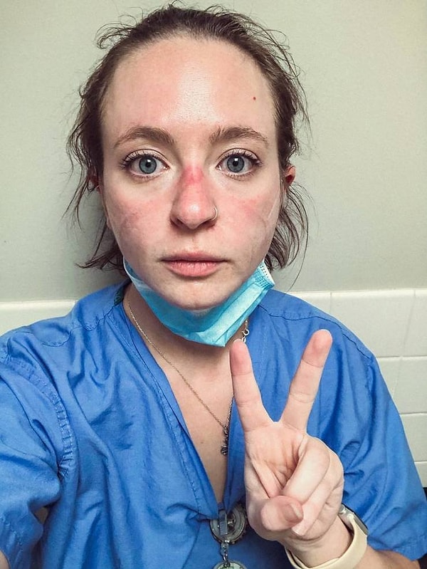 6. Вот так выглядит Кэтрин после 9 месяцев неустанной борьбы с коронавирусом за жизнь пациентов.