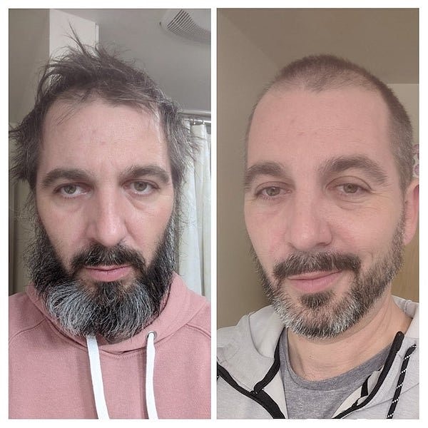 14. «До и после попытки что-то сделать с моей депрессией»