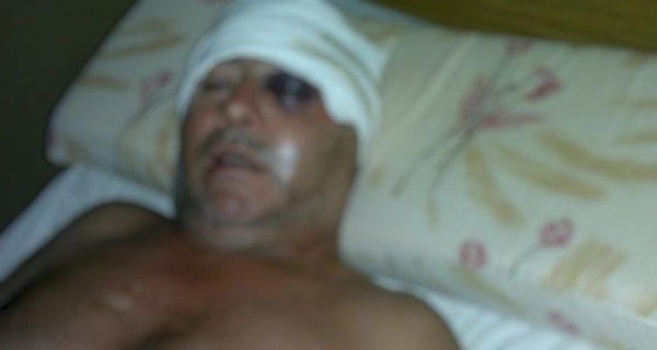 Позже,на просочившейся в прессу фотографии видно, что Диего Молина, сделавший селфи злополучное селфи, был избит.