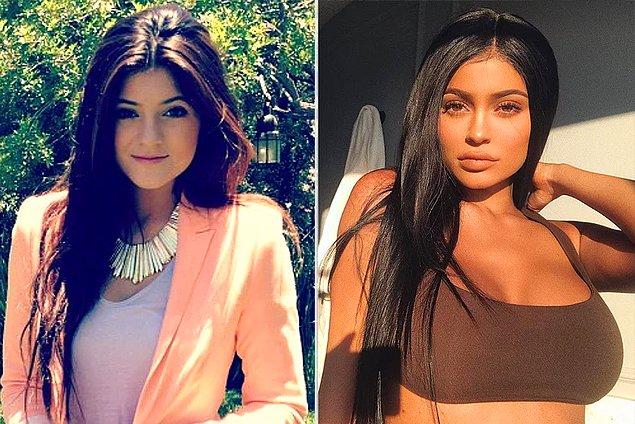 2015: Kylie Jenner göğüs dolgusu mu yaptırdı?