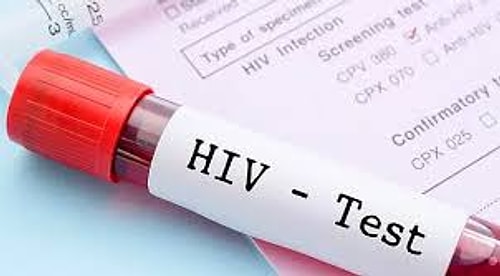 Hepimizin Korktuğu ve Ölümcül Bir Hastalık Olarak Gördüğümüz AIDS ve HIV+ Hakkında Bilmemiz Gerekenler