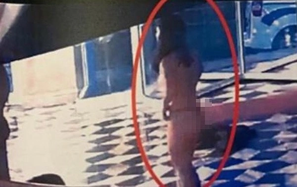 Otel görevlisi 155'i arayarak yardım istedi.