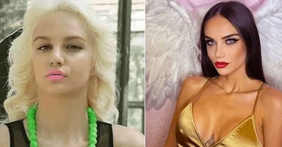 Adeta Başka Birine Dönmüş! Estetiğin Gözüne Gözüne Vuran Ayşenur Balcı'nın Yıllar İçindeki Değişimi