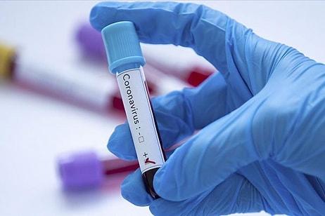 Covid 19 Test Sonucu Sorgulama Nasıl Yapılır? İşte E Nabız Koronavirüs Test Sonucu Öğrenme Ekranı...