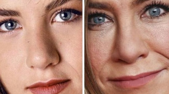 Тогда и сейчас: фото селебрити с разницей в 10-20 лет