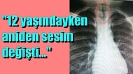 4. Evre Kanseri Yenerek Bu Hayata Tutunmak İçin Çok Fazla Sebep Olduğunu Gösteren Savaşçının Hikayesi!